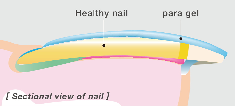 Para Gel